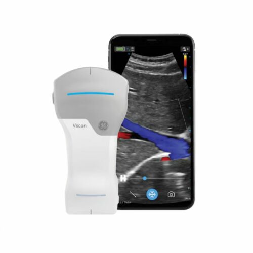 GE Vscan Portable Handheld Ultrasound